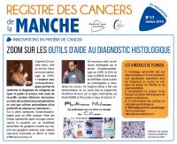 2018_01_17eme_billetin_registre_des_cancers_de_la_manche_planuca_2